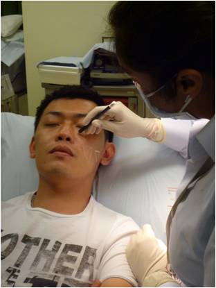 sculptura anti aging treatment sculptura anti aging treatment