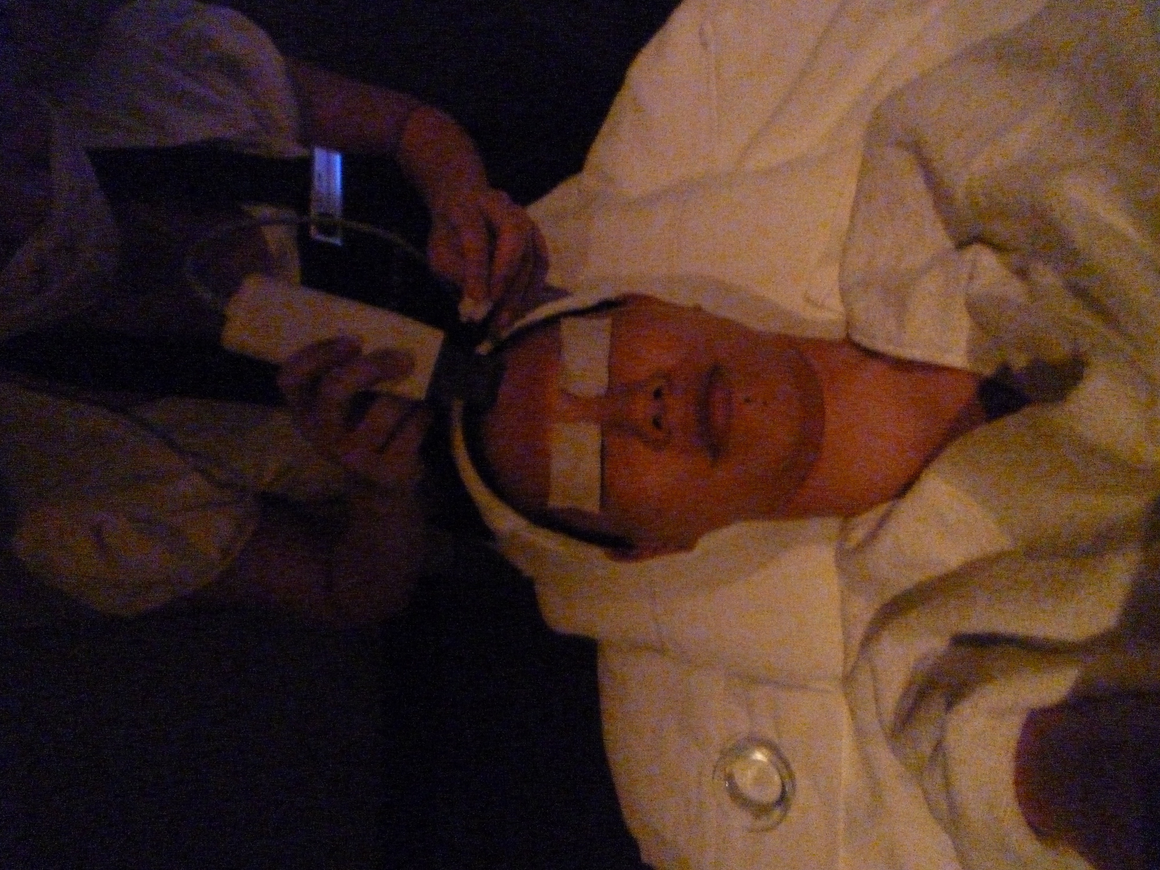 dermabrasion dermabrasion