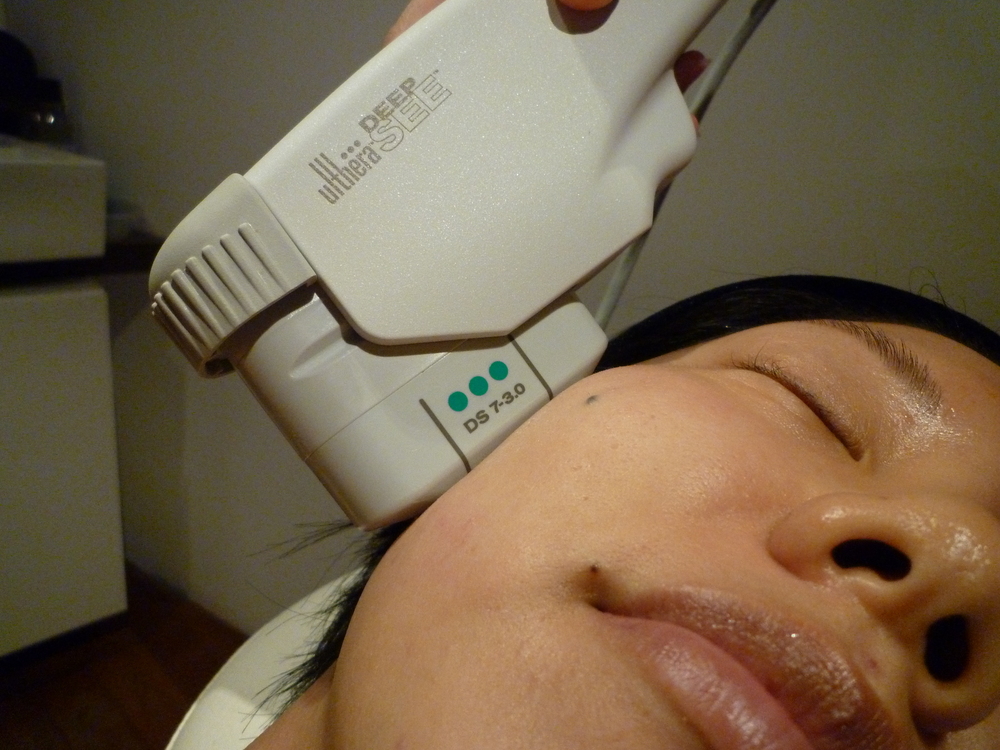 ulthera treatment