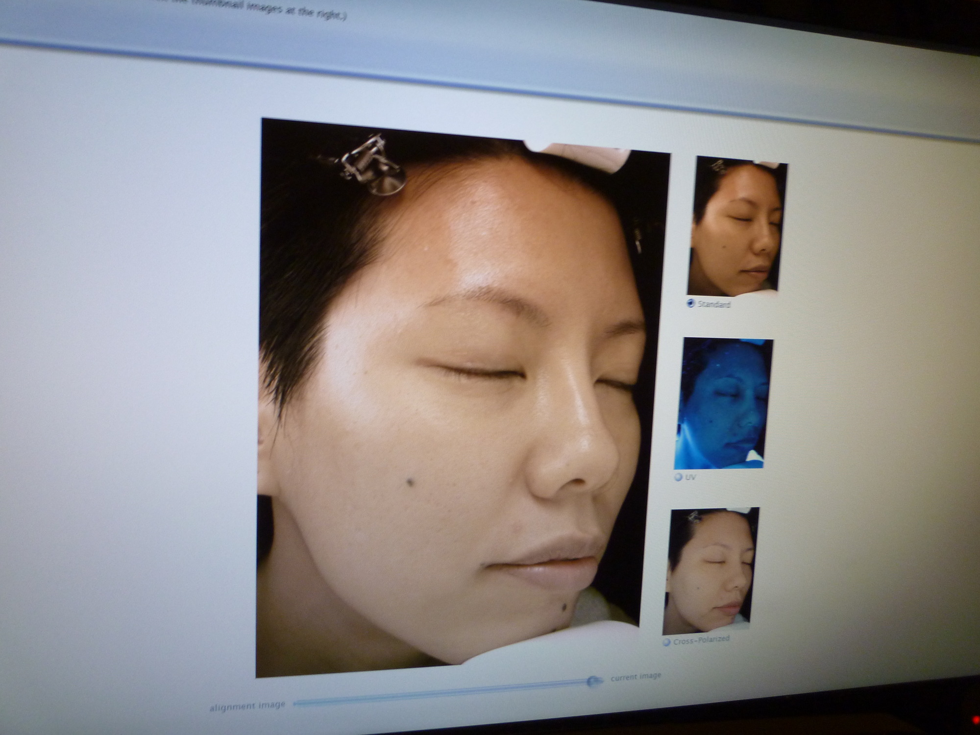 face analysis