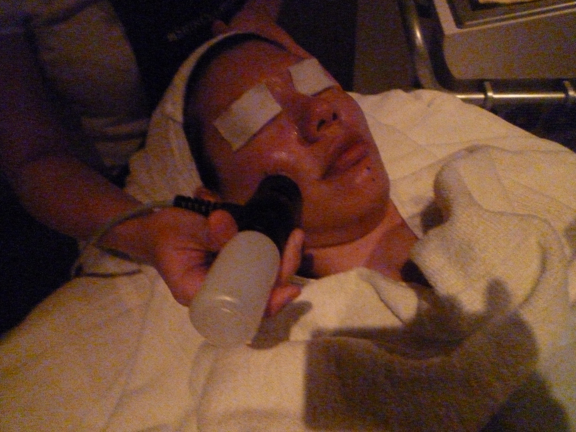 electroporation electroporation