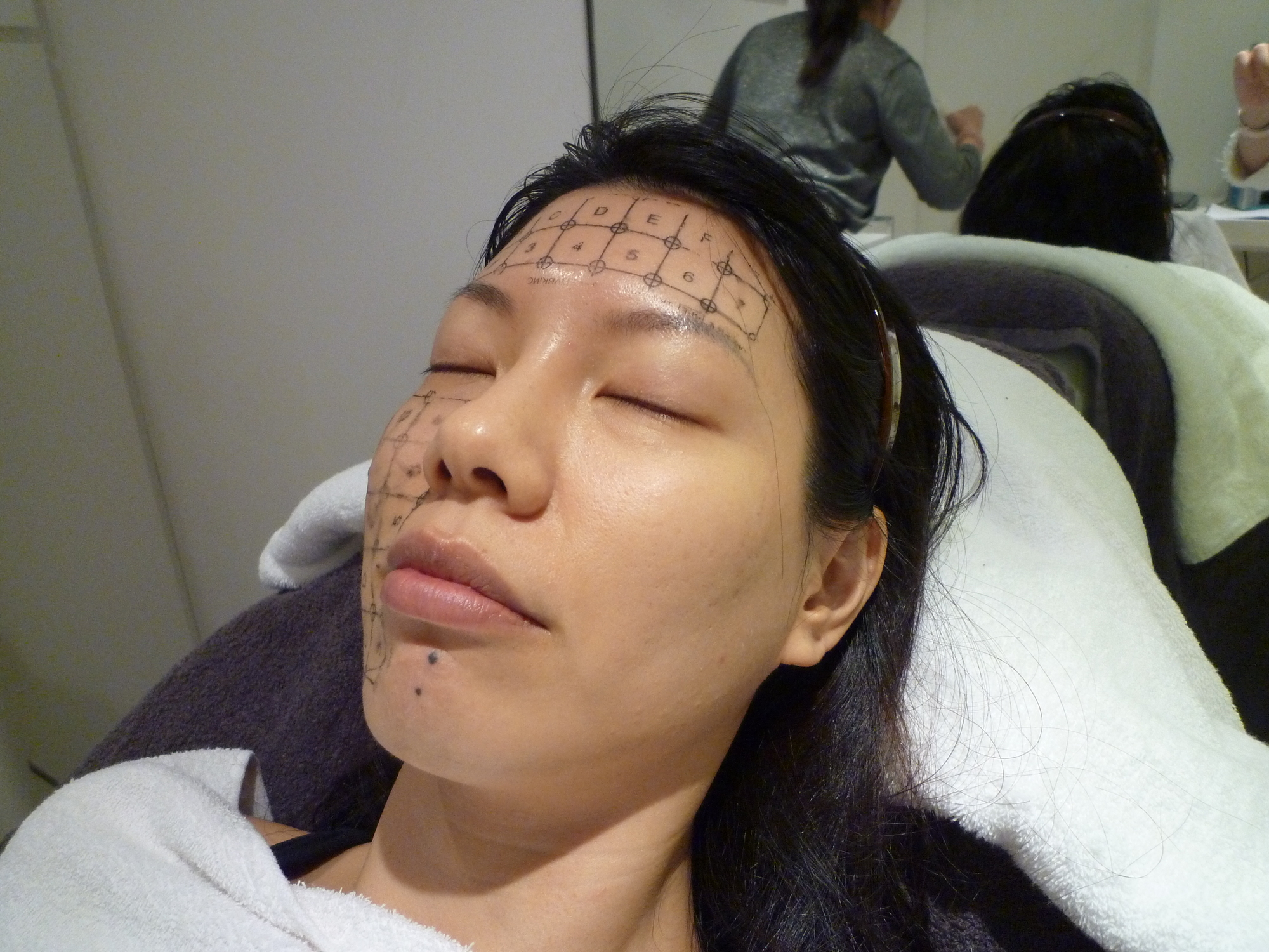 Thermage CPT Thermage CPT