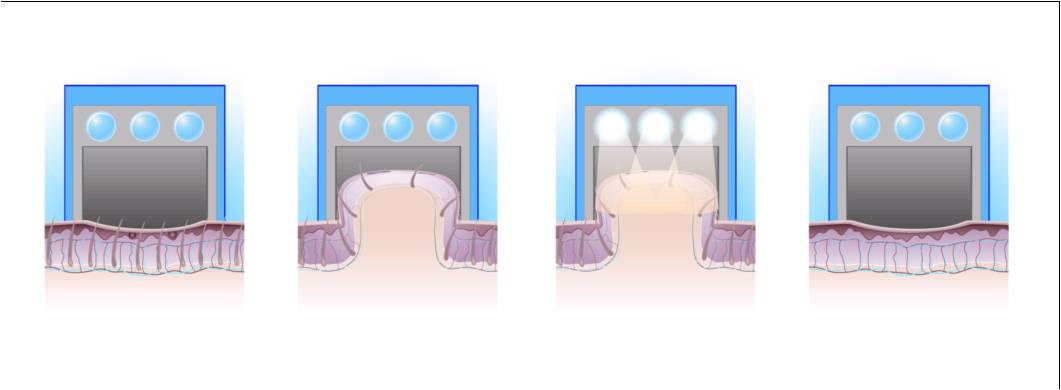 PPx technology